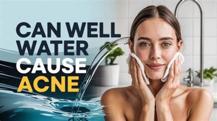 Can well water be soft