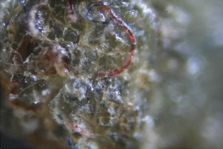 Is Morgellons a fungus