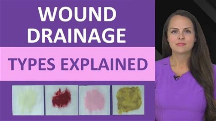 Is serous drainage bad