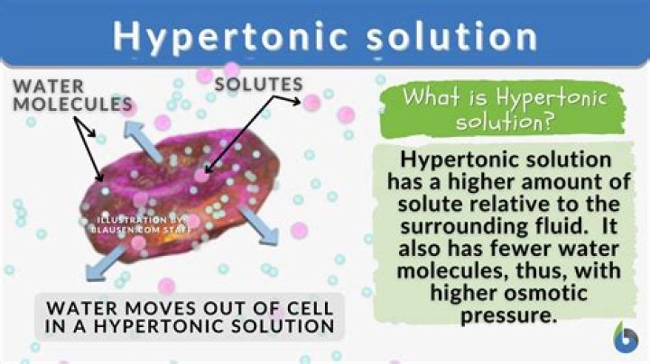 Is vomiting hypertonic
