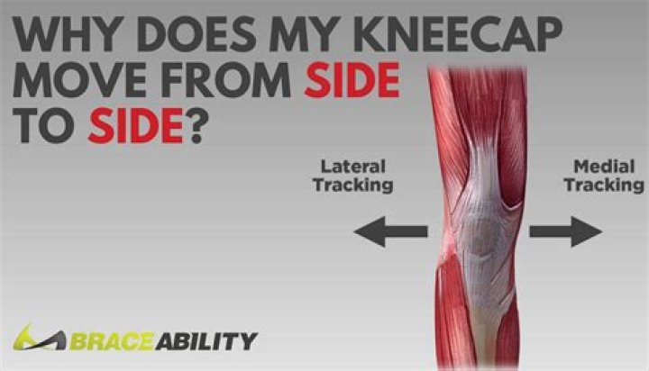 Should my patella move